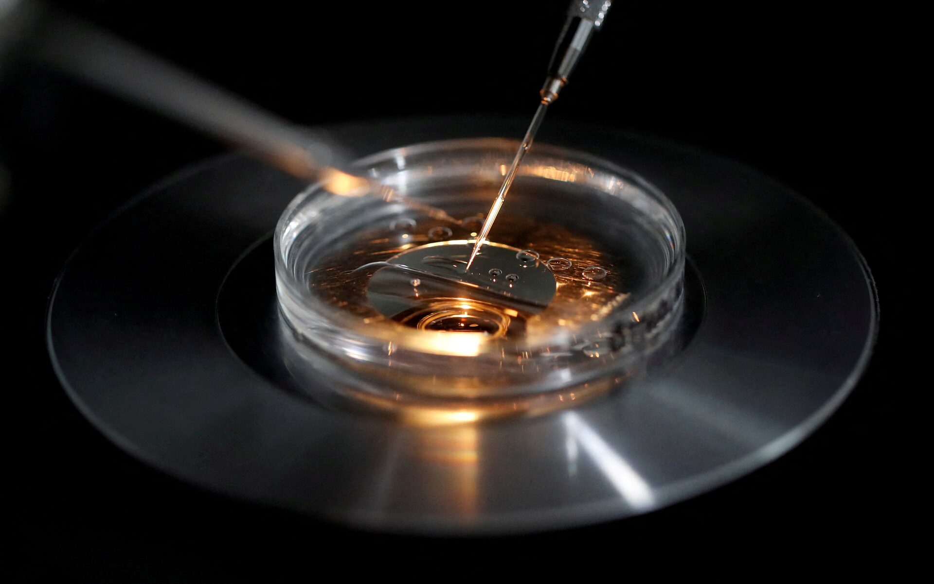 IVF