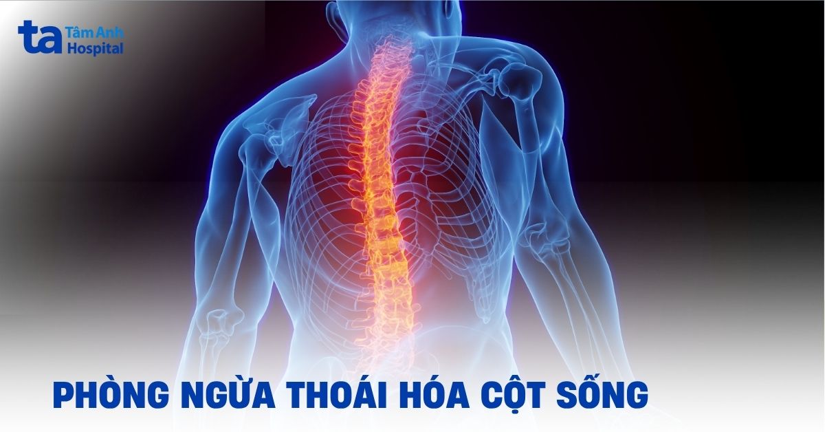 Phong Ngua Thoai Hoa Cot Song