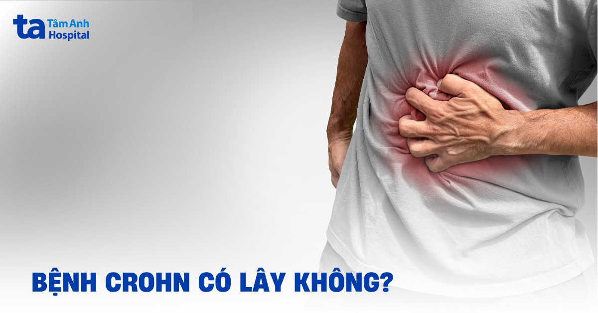 Benh Crohn Co Lay Khong