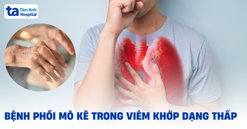 Bệnh Phổi Mô Kẽ Trong Viêm Khớp Dạng Thấp Benh Phoi Mo Ke Trong Viem Khop Dang Thap
