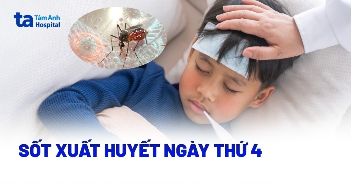 Bi Sot Xuat Huyet Ngay Thu 4