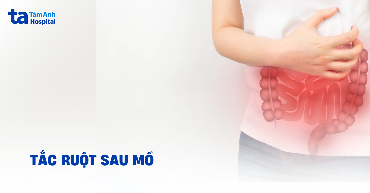Bi Tac Ruot Sau Mo