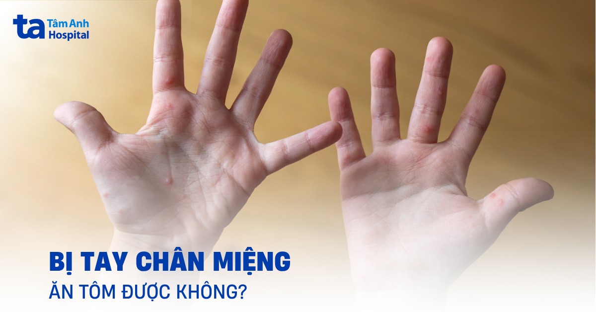 Bi Tay Chan Mieng An Tom Duoc Khong