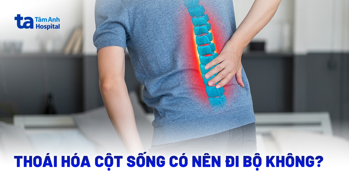 Bi Thoai Hoa Cot Song Co Nen Di Bo Khong