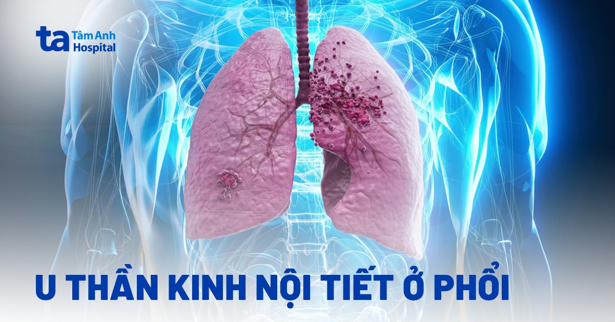 Cac Thong Tin Ve U Than Kinh Noi Tiet O Phoi
