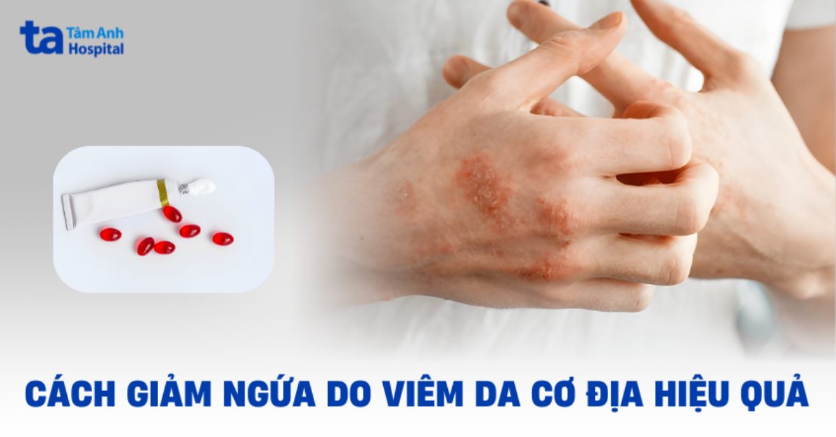 Cach Giam Ngua Khi Bi Viem Da Co Dia
