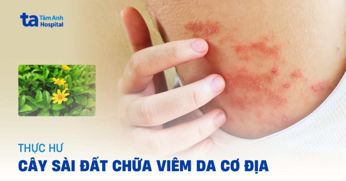 Cay Sai Dat Chua Viem Da Co Dia