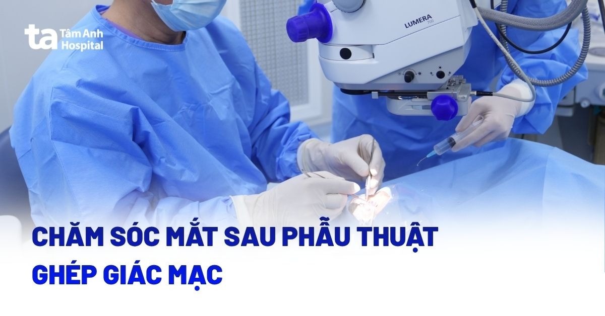 Cham Soc Mat Sau Phau Thuat Ghep Giac Mac