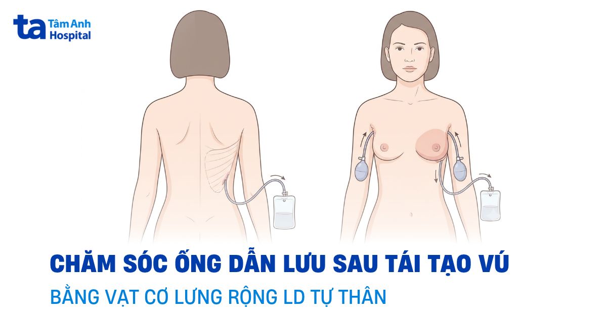 Cham Soc Ong Dan Luu Sau Tai Tao Vu Bang Vat Co Lung Rong 1