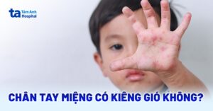 Chan Tay Mieng Kieng Gio Khong