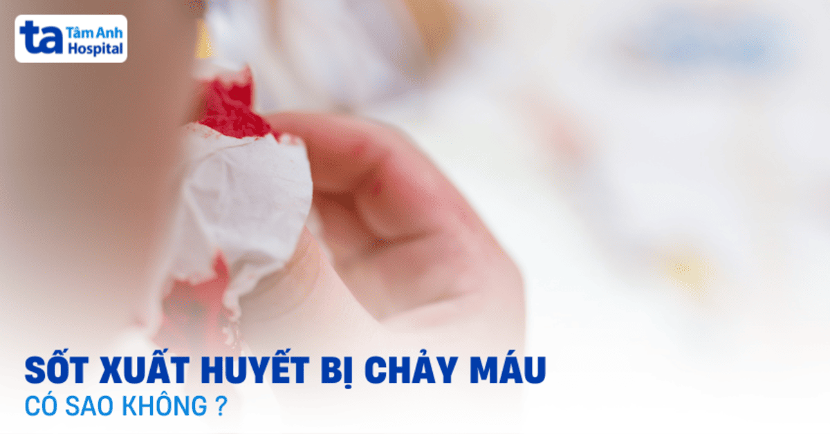 Chay Mau Khi Bi Sot Xuat Huyet