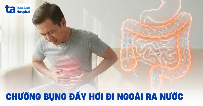 Chuong Bung Day Hoi Di Ngoai Ra Nuoc