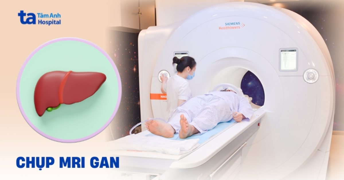Chup Mri Gan 1