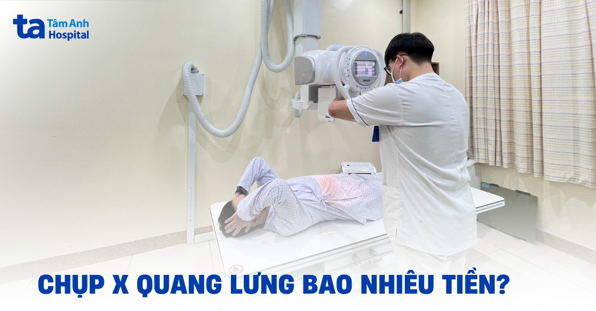 Chup X Quang Lung Bao Nhieu Tien