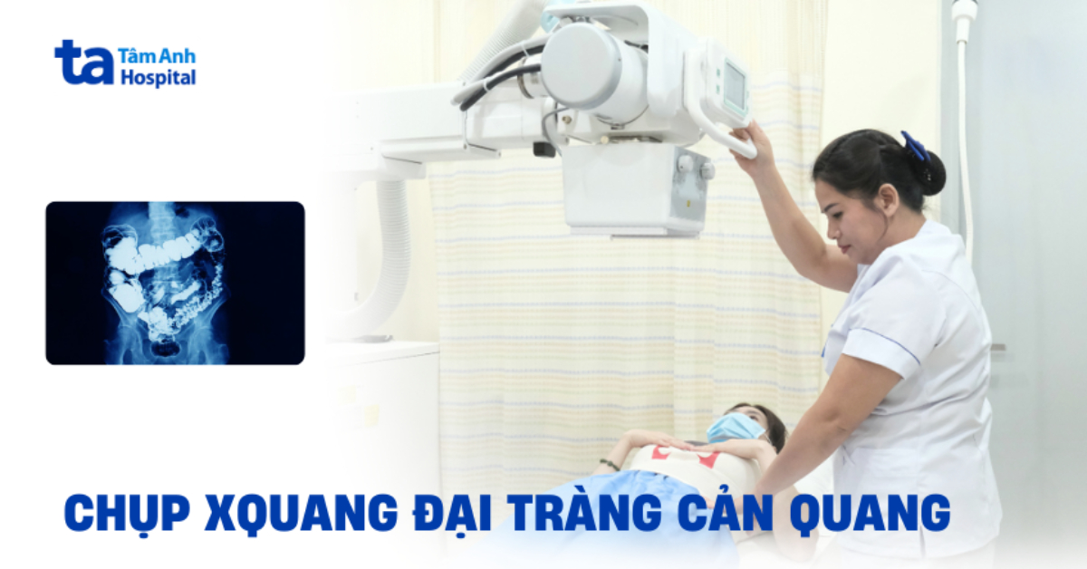 Chup Xquang Dai Trang Can Quang