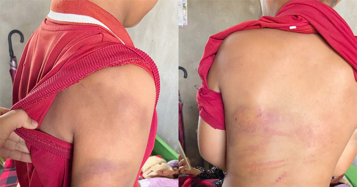 den tham chau trai ba ngoai phat hien chuyen dau long voi trinh bao cong an 1500