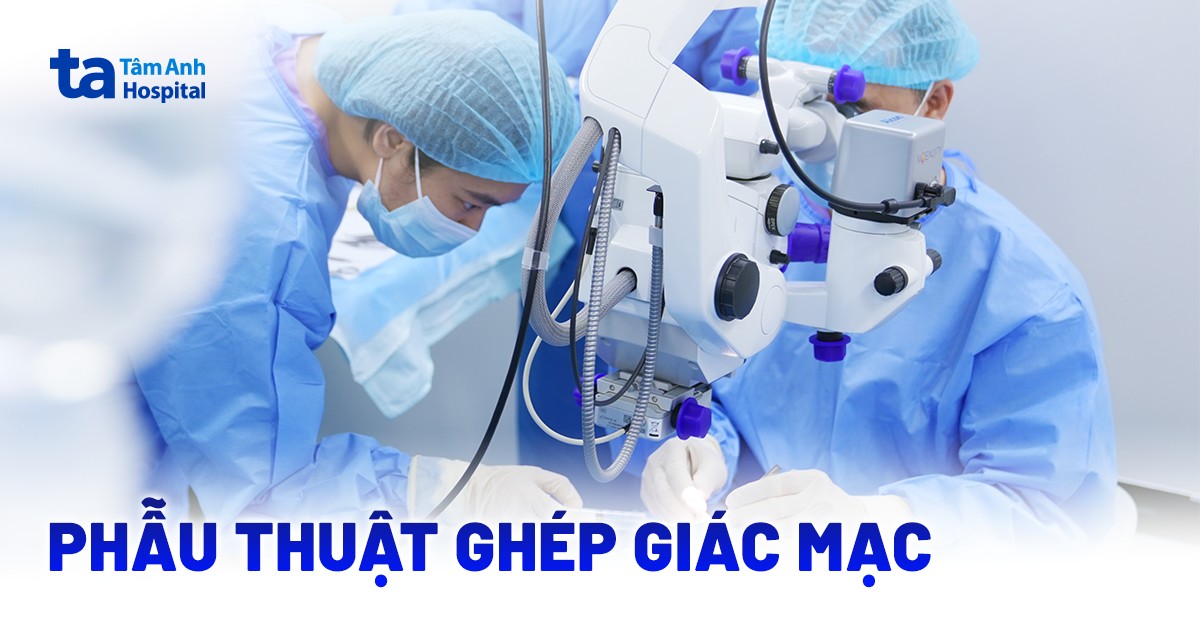 Ghep Giac Mac