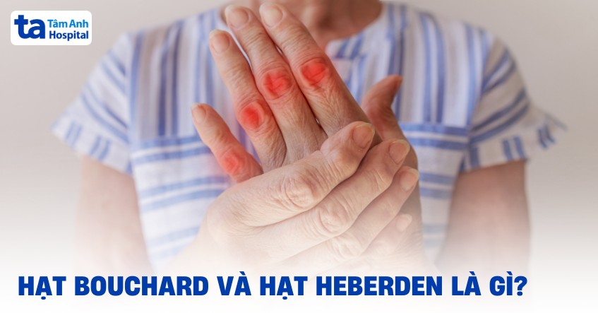Hat Bouchard Va Hat Heberden