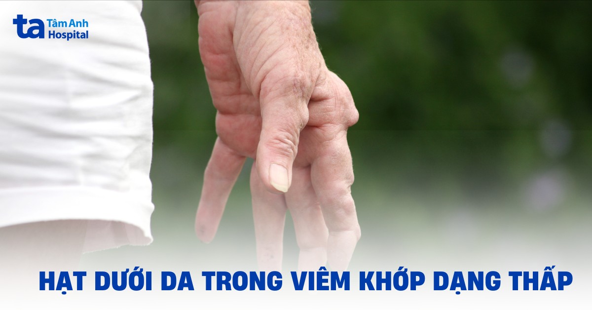Hat Duoi Da Trong Viem Khop Dang Thap