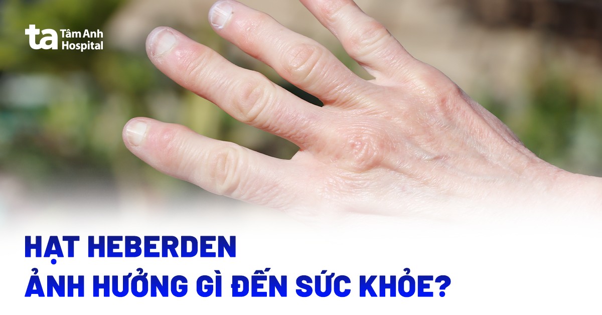 Hat Heberden