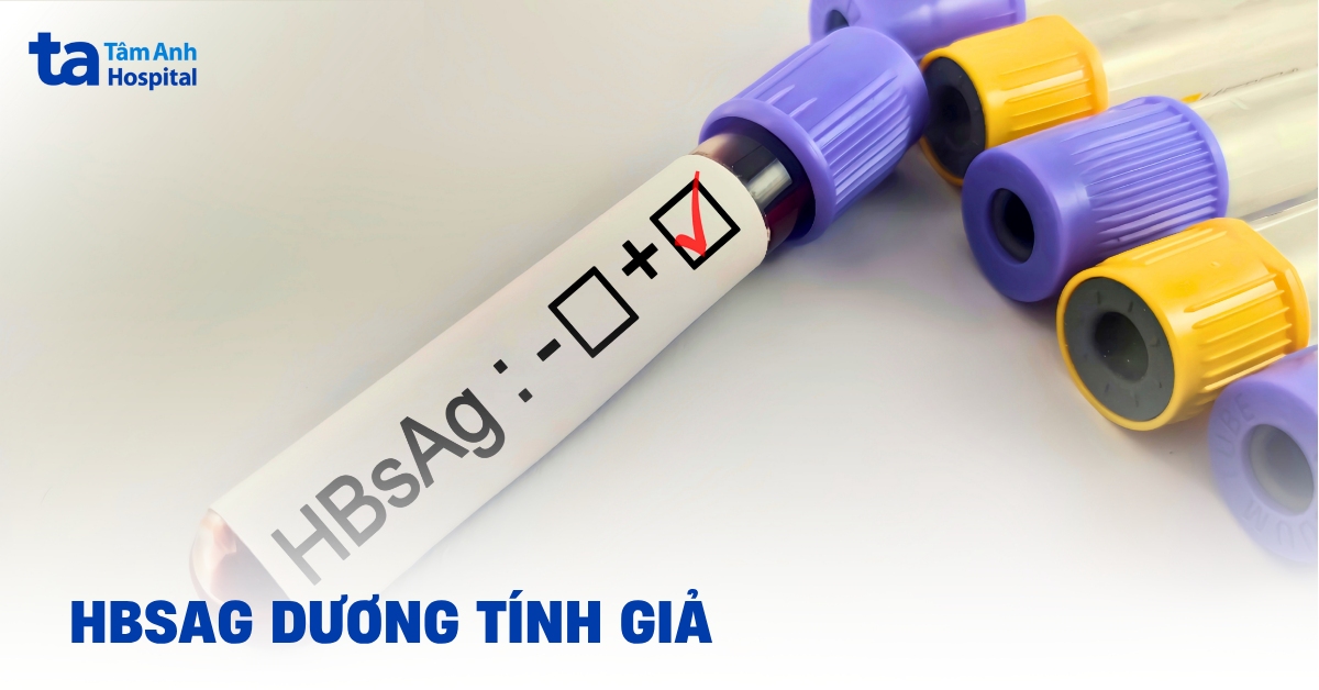 Hiểu Đúng Về Hbsag Dương Tính Giả Trong Xét Nghiệm Hbsag Duong Tinh Gia