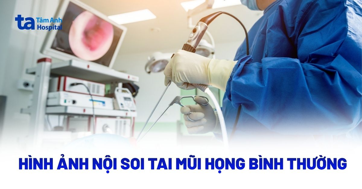 Hinh Anh Noi Soi Tai Mui Hong Binh Thuong
