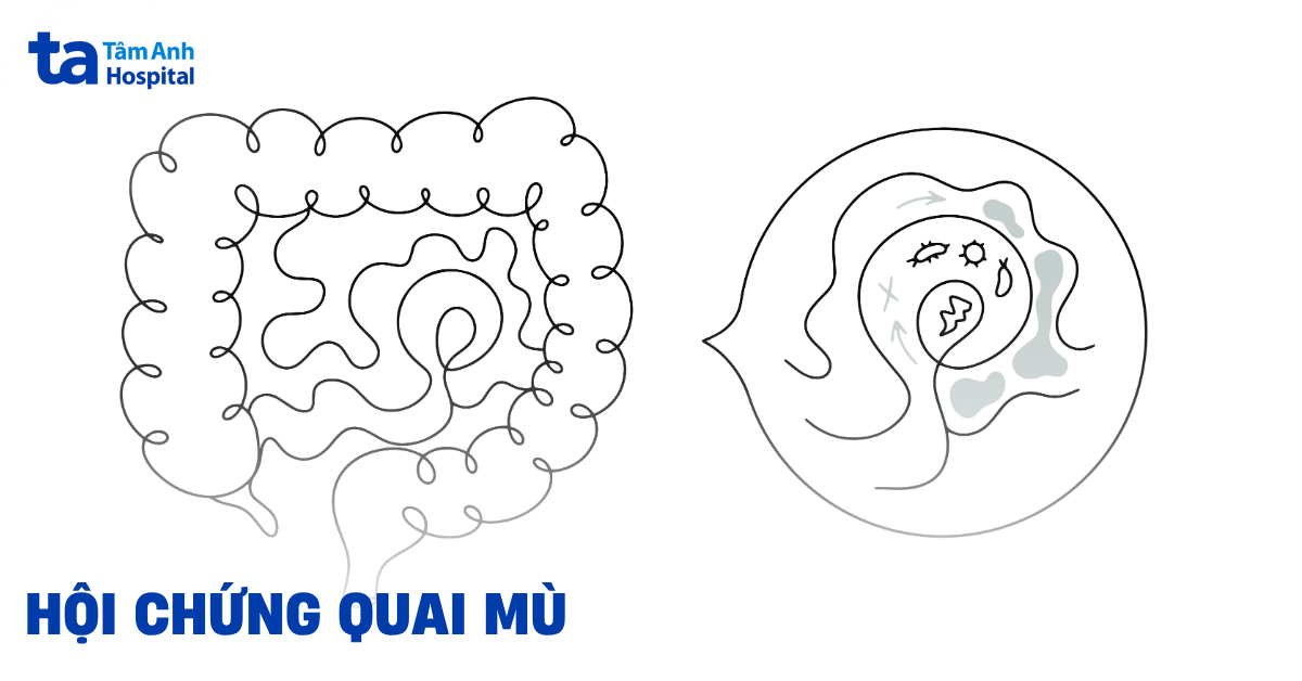 Hoi Chung Quai Mu