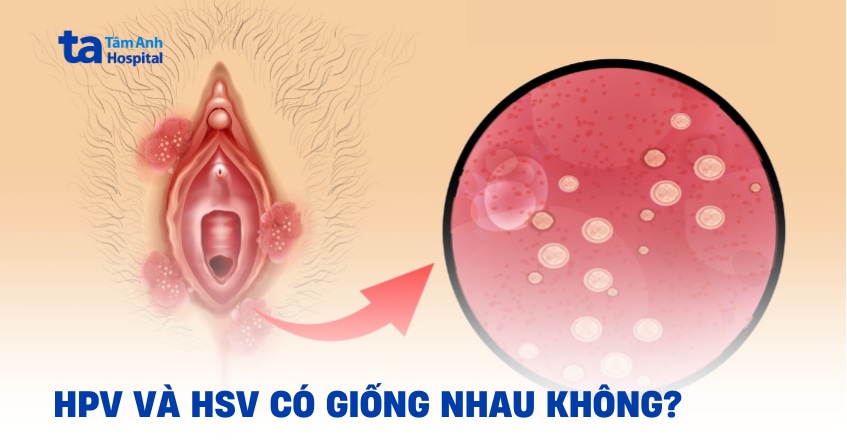 Hpv Va Hsv Co Giong Nhau Khong