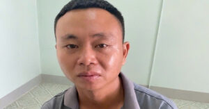 Khoi To Cha Duong Bop Co Tat Lien Tiep Con Rieng 3 Tuoi Cua Vo 740