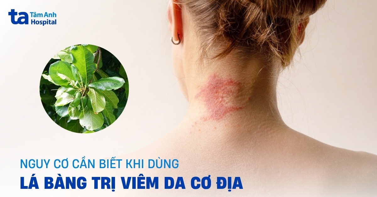 La Bang Tri Viem Da Co Dia