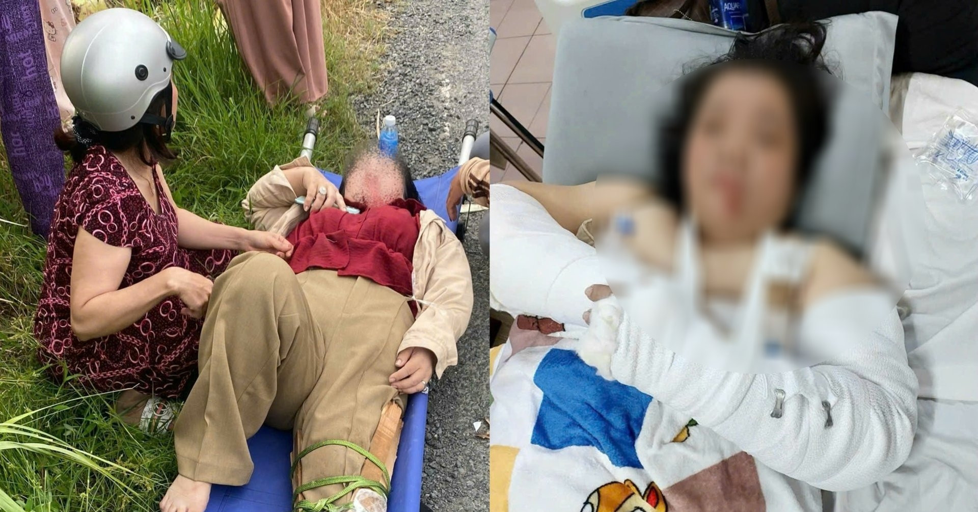 Lien Tiep 3 Vu Tai Nan Tren Doan Duong Chi Chit O Ga Co Co Giao Gay Ca Tay Va Chan 3751