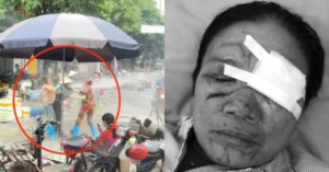 lien tiep xay ra cac vu xit voi nuoc cao ap vao nguoi khac luat su noi gi 3565