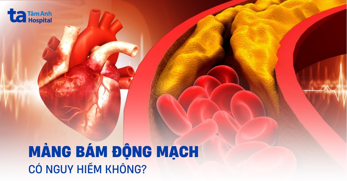Mang Bam Dong Mach