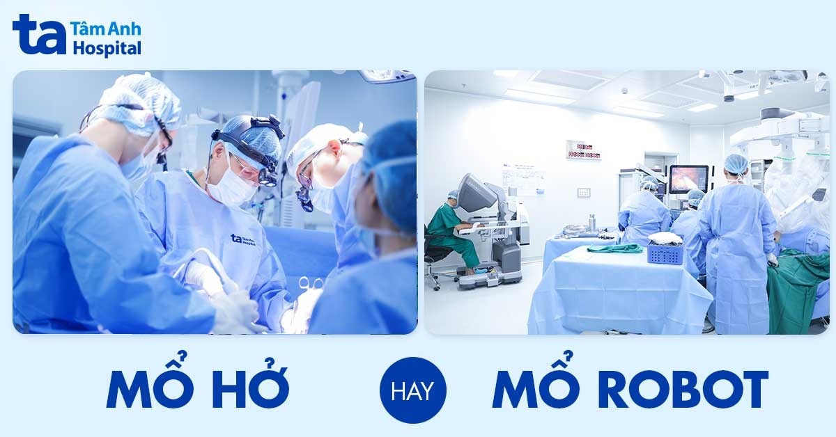 Mo Ho Hay Mo Robot