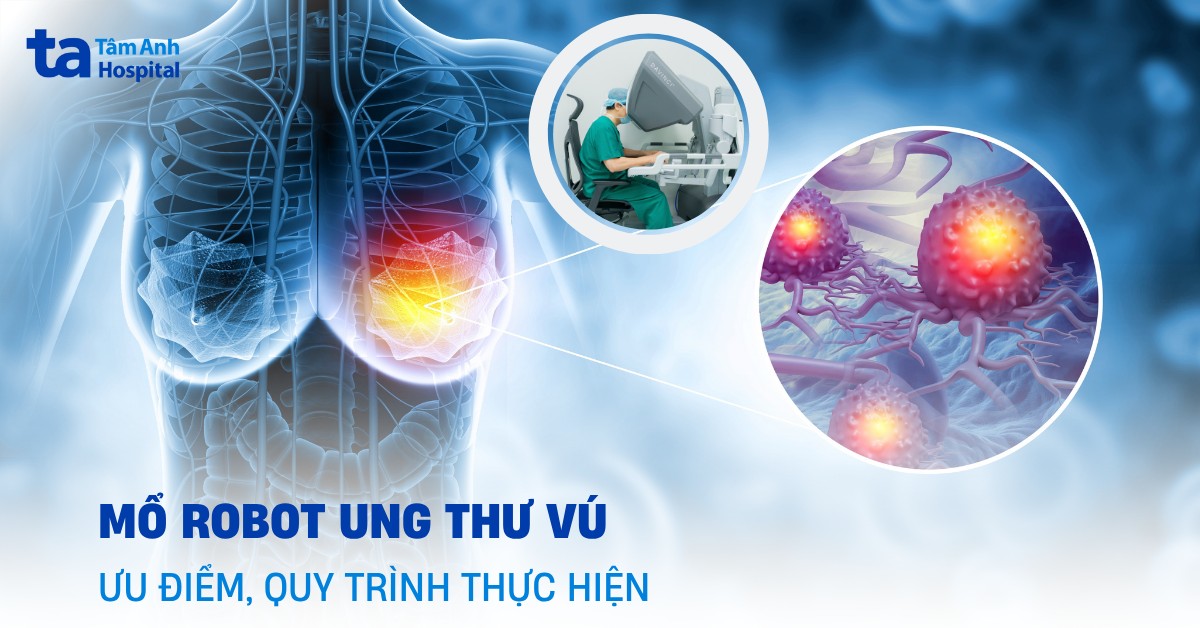 Mo Robot Ung Thu Vu