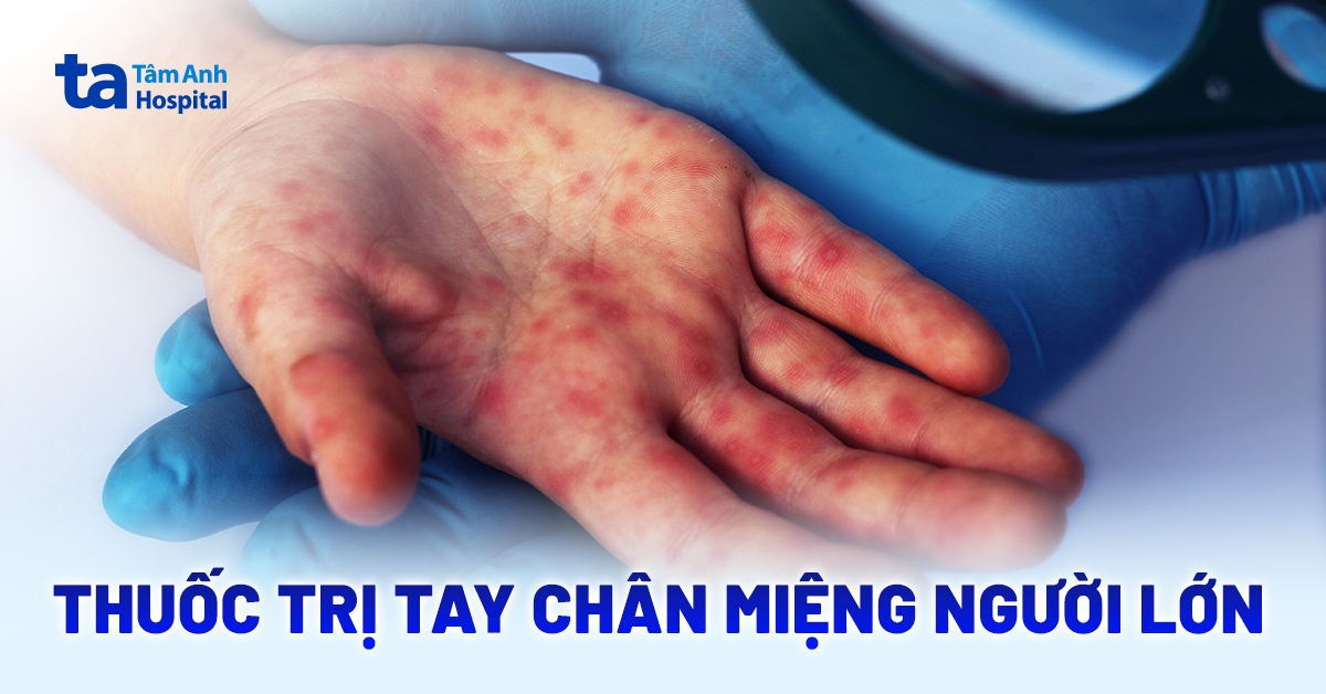 Nguoi Lon Bi Tay Chan Mieng Uong Thuoc Gi