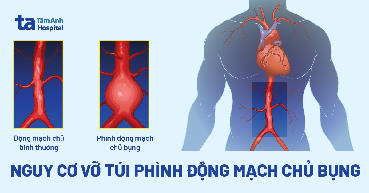 Nguy Co Vo Tui Phinh Dong Mach Chu Bung