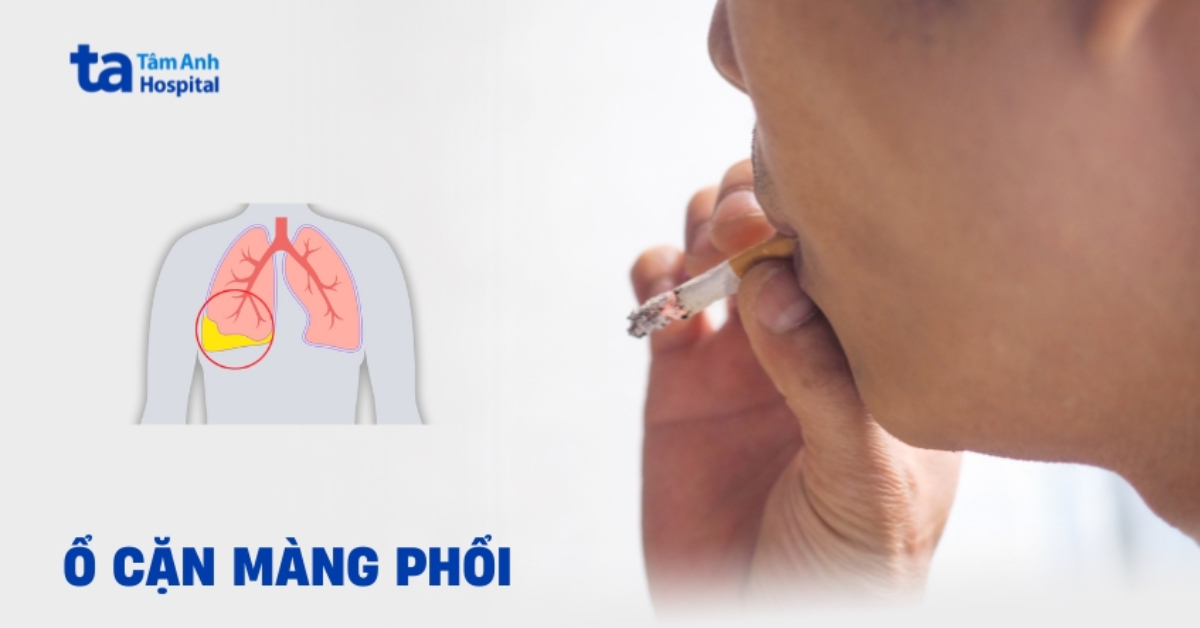 O Can Mang Phoi La Gi