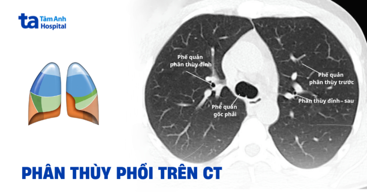 Phan Thuy Phoi Tren Ct