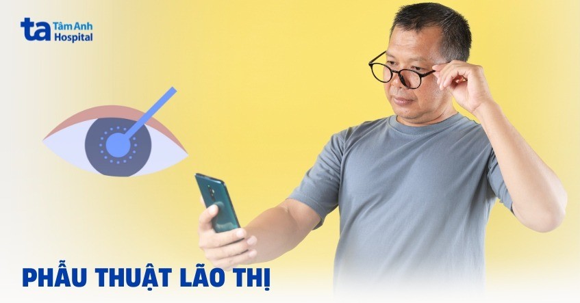 Phau Thuat Lao Thi