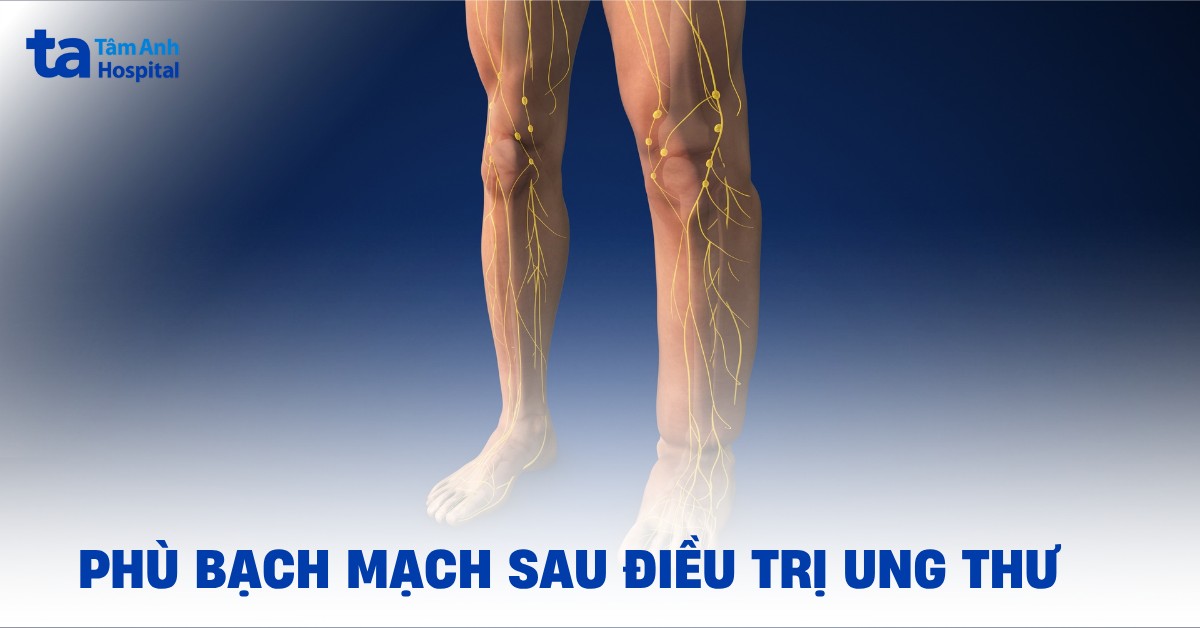 Phu Bach Mach Sau Dieu Tri Ung Thu