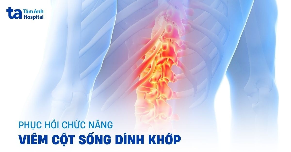 Phuc Hoi Chuc Nang Viem Cot Song Dinh Khop