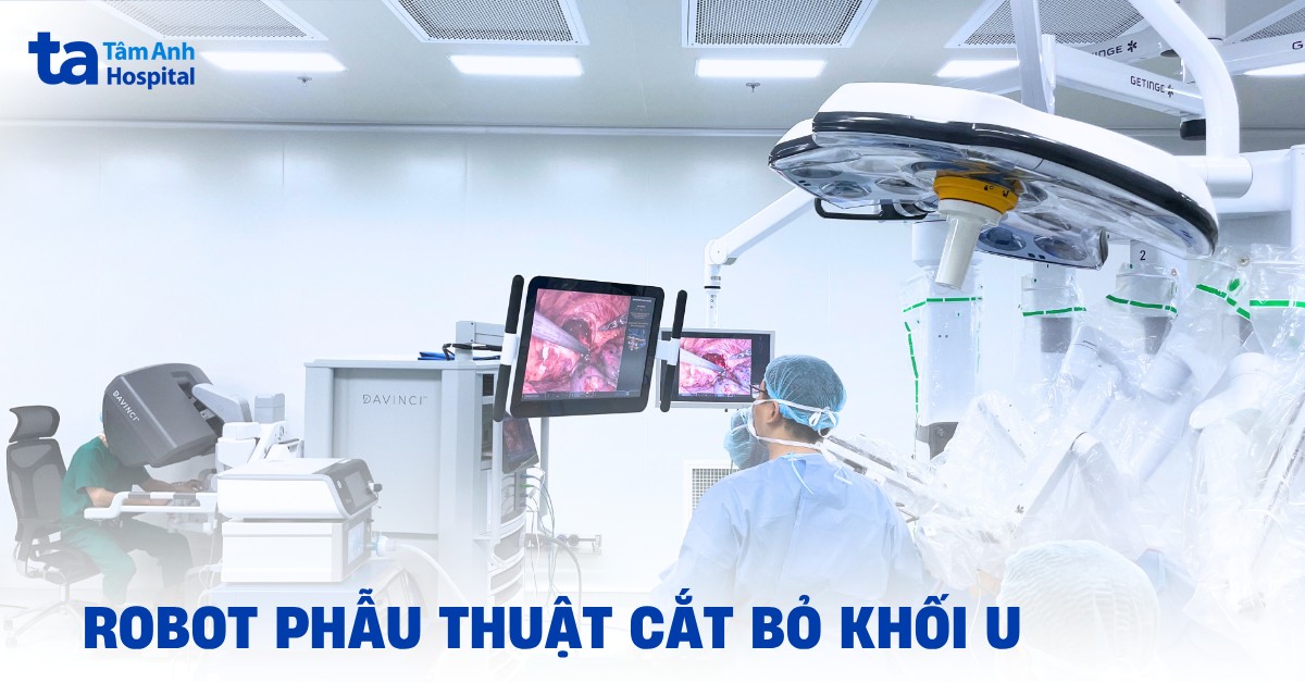 Robot Phau Thuat Cat Bo Khoi U