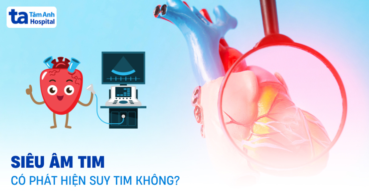 Sieu Am Tim Co Phat Hien Suy Tim Khong