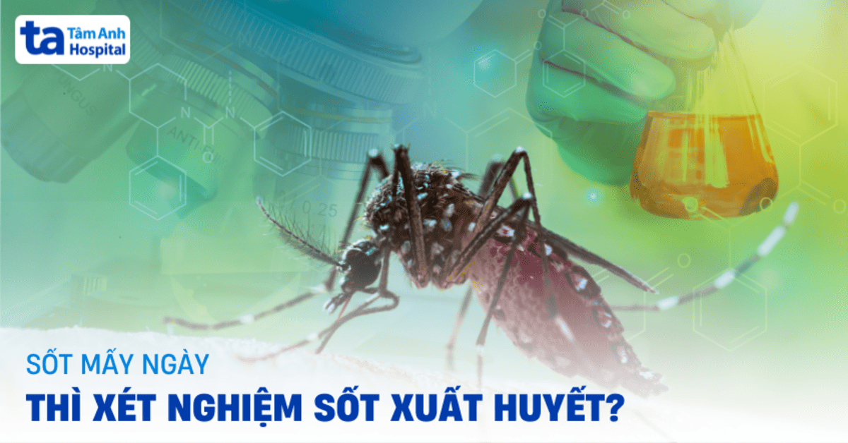 Sot Bao Nhieu Ngay Thi Xet Nghiem Sot Xuat Huyet