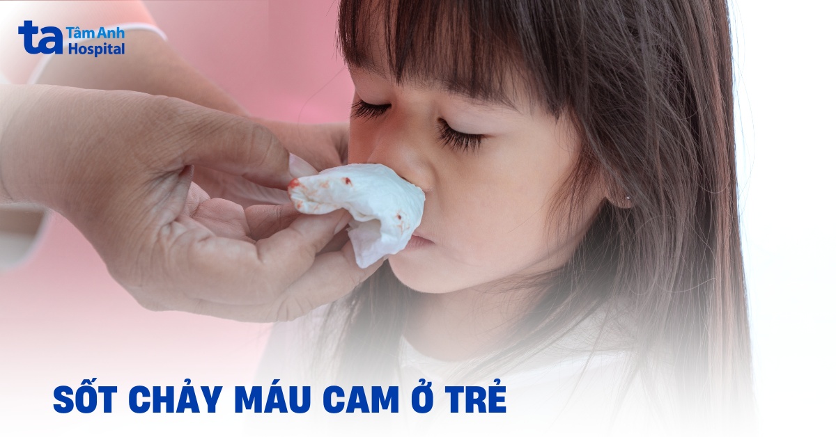 Sot Chay Mau Cam O Tre Do Dau