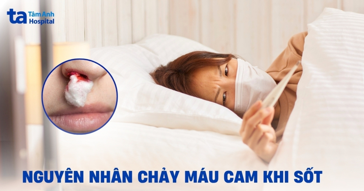 Sot Chay Mau Mui