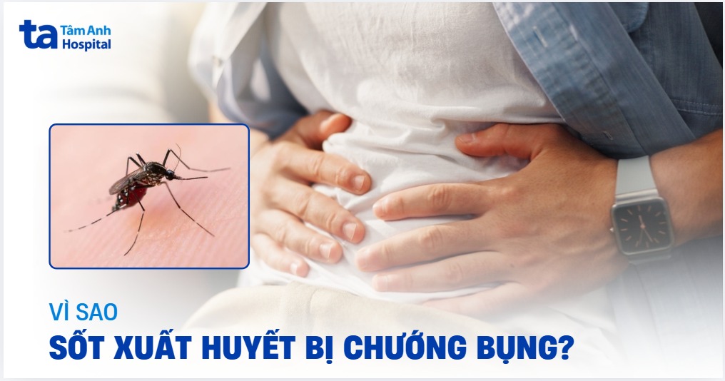 Sot Xuat Huyet Bi Chuong Bung
