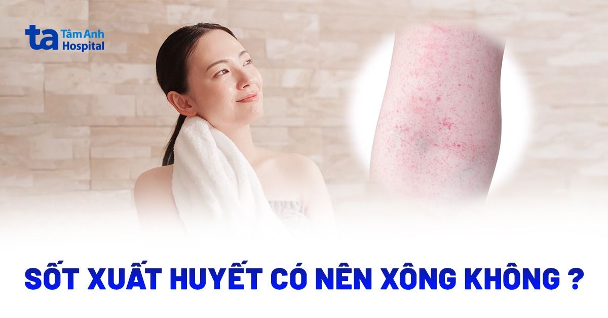 Sot Xuat Huyet Co Nen Xong Khong