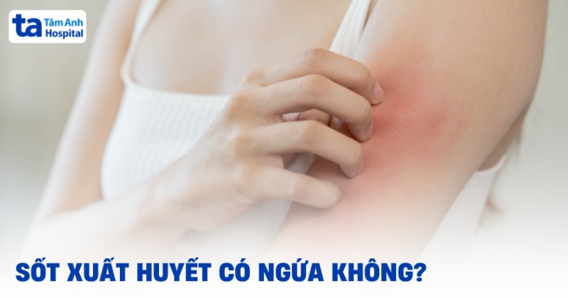 Sot Xuat Huyet Co Ngua Khong